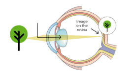 PRATS Presbyopia Group